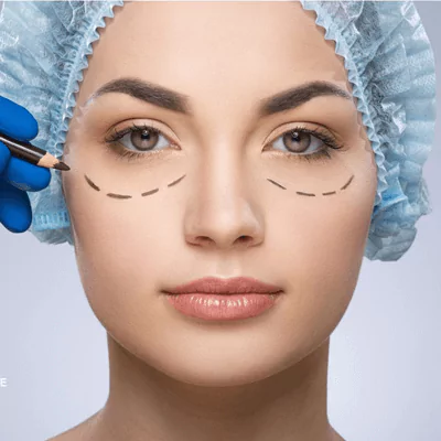 eyelid surgery lina surgery istanbul health tourism turkey 65b1afcdc0a81 Anasayfa