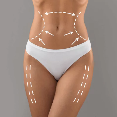 mommy makeover lina surgery istanbul health tourism turkey 65b1afcf5351b Anasayfa Mommy Makeover Lina Surgery İstanbul health tourism Turkey