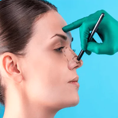 nose job rhinoplasty lina surgery istanbul health tourism turkey 65b1afcfedec8 Anasayfa